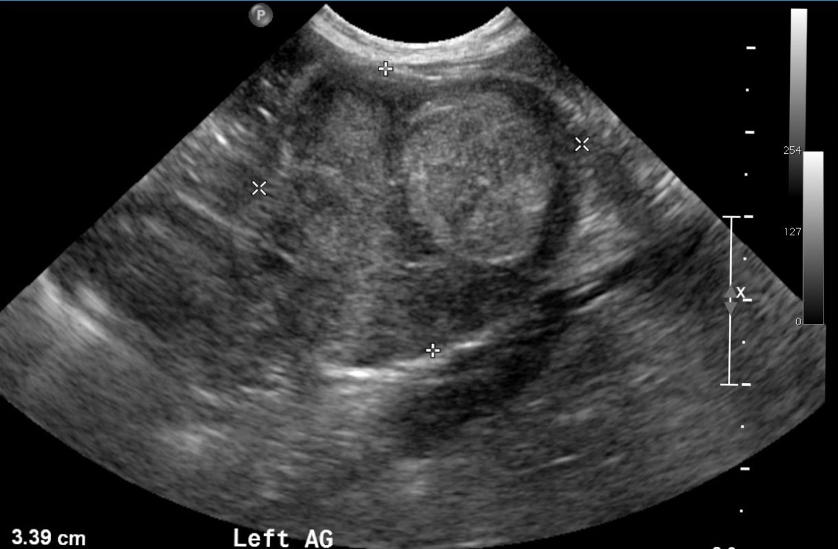 Large Mass In Dog S Lung Large Mass In Dog S Lung