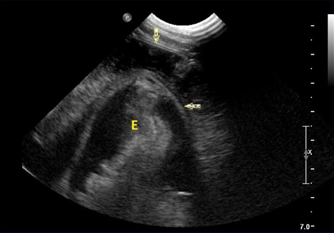 intussusception in dogs a of gastro oesophageal intussusception in a vetpixel intussusception in dogs a of gastro oesophageal intussusception in a vetpixel