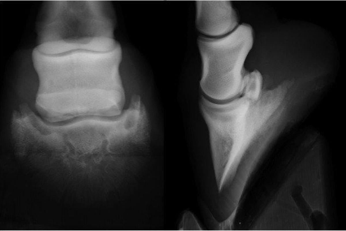 Un cas de fragment osteochondral de l'os naviculaire chez un cheval