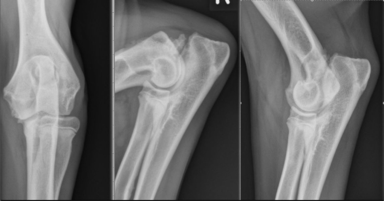 Case A case of non-union of the anconeus process and fragmentation of the medial coronoid process in a dog