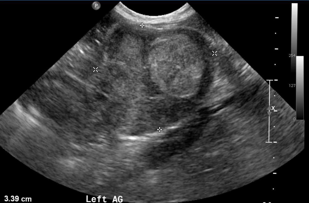 Case A case of malignant pulmonary and adrenal masses in a dog