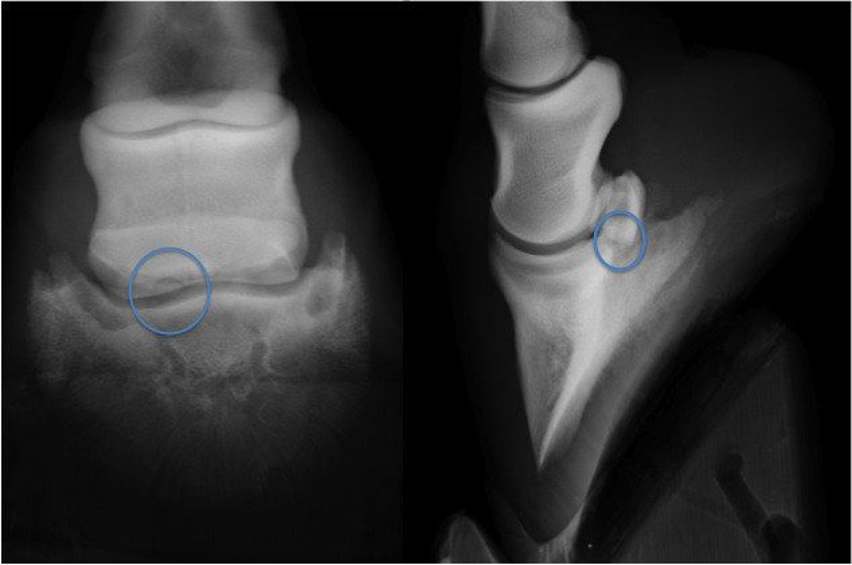 Case A case of osteochondral fragmentation of the navicular bone in a horse