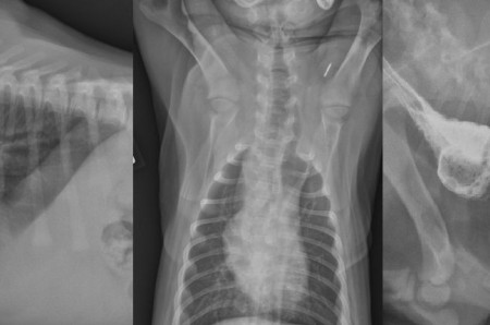 Un cas de jabot oesophagien associé à une persistance du 4ème arc aortique chez un jeune chien