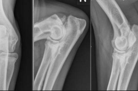 Un cas de non-union du processus anconé et de fragmentation du processus coronoïde médial chez un chien