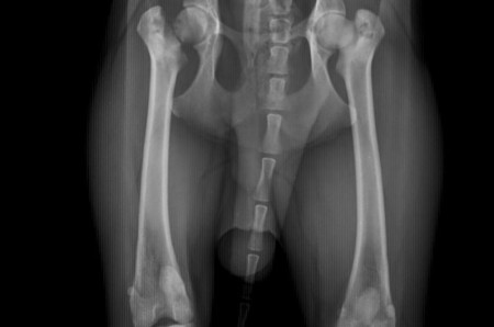A case of bilateral femoral metaphyseal osteopathy in a dog