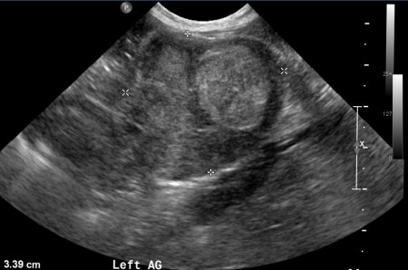 A case of malignant pulmonary and adrenal masses in a dog