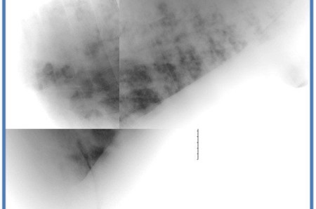 A case of viral bronchopneumonia in a horse